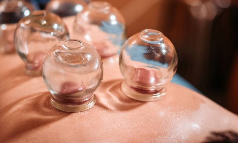 cupping